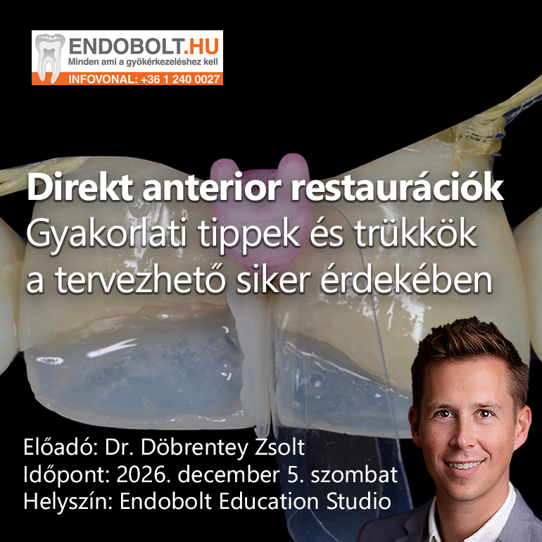 Direkt anterior restaurációk