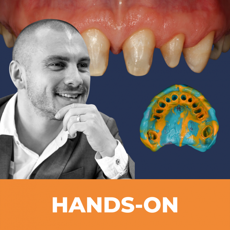 Tökéletesített tangenciális preparálási technikák - Dr Kovács Tamás hands-on tréningje