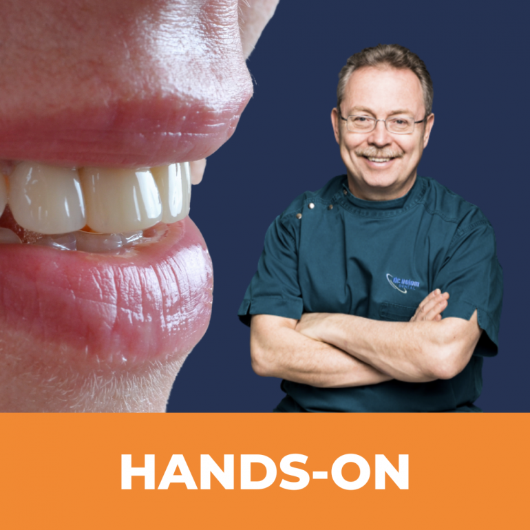 Polírozás Magasabb Szinten – Hands-on Tréning