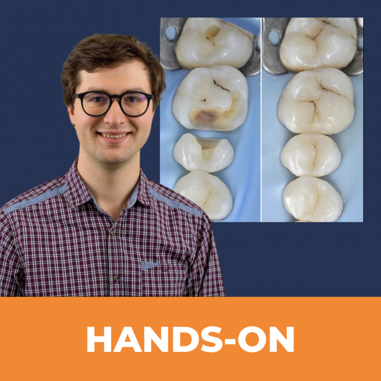 Útmutató a különlegesen élethű moláris direkt restaurációkhoz- Mindaugas Kudelis hands-on tréningje