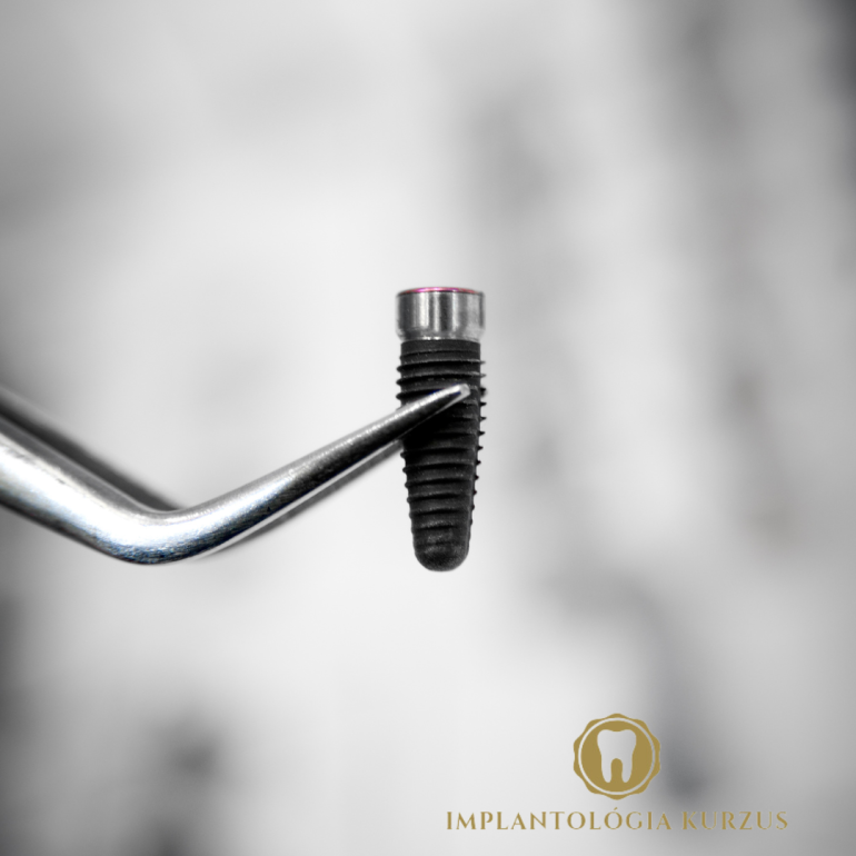 Az alapoktól a mester fokozatig! 10 napos orális implantológiai kurzus. 2. rész