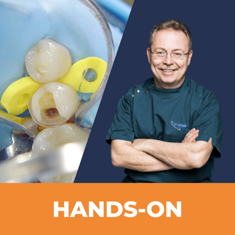 Matrica Hardcore: Szekcionált és Speciális Matricák Használata Nehéz Esetekben