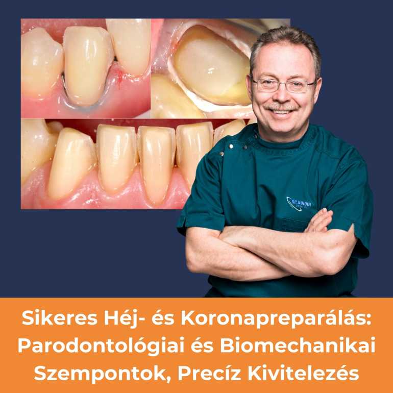 Sikeres Héj- és Koronapreparálás: Parodontológiai és Biomechanikai Szempontok, Precíz Kivitelezés