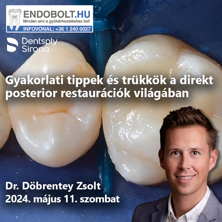 Gyakorlati Tippek és Trükkök a direkt posterior restaurációk világában