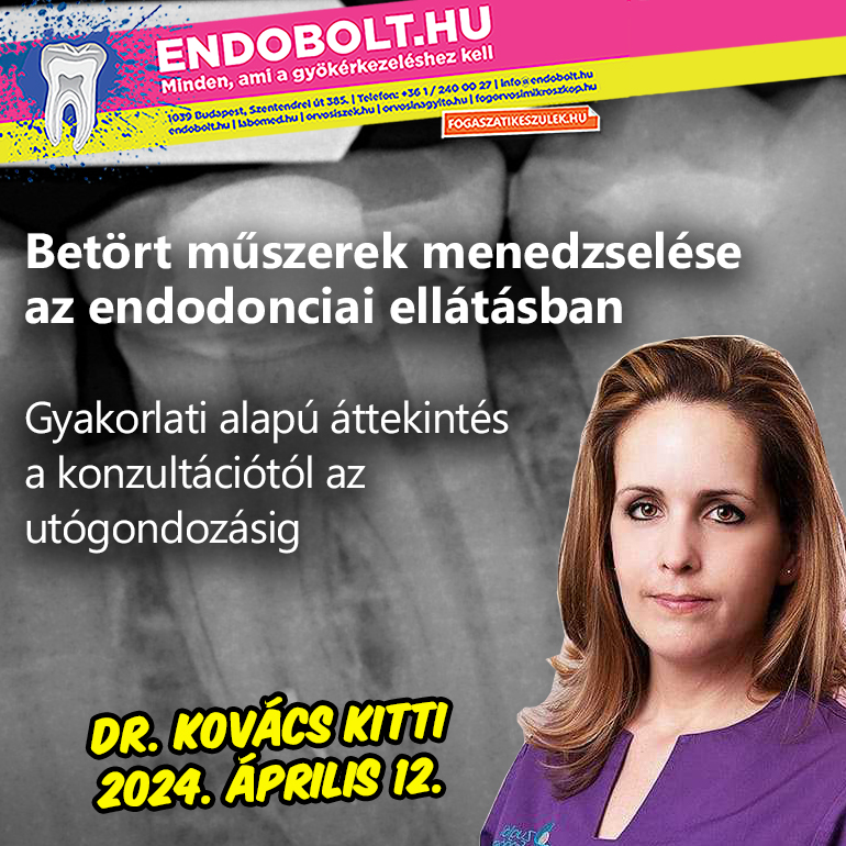 Betört műszerek menedzselése az endodonciai ellátásban