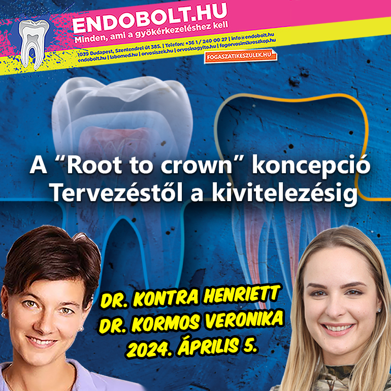 A ‘Root to Crown’ koncepció - tervezéstől a kivitelezésig