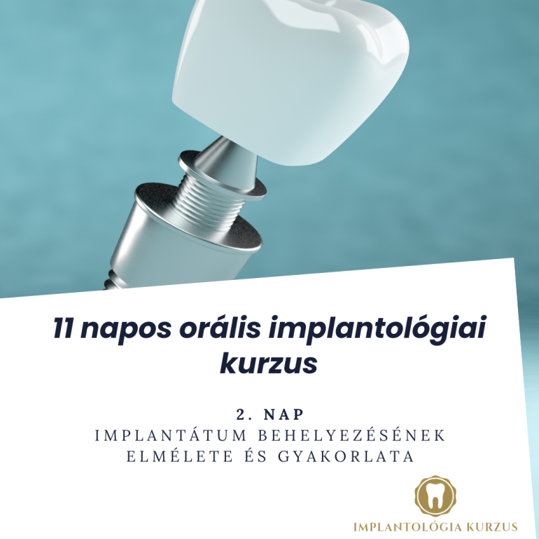 Az alapoktól a mester fokozatig! 11 napos orális implantológiai kurzus. 2. rész