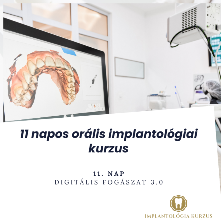 Az alapoktól a mester fokozatig! 11 napos orális implantológiai kurzus. 11. rész