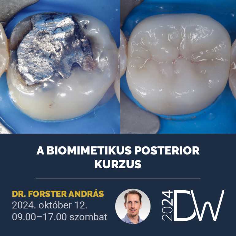 A Biomimetikus Posterior Hands-on Kurzus
