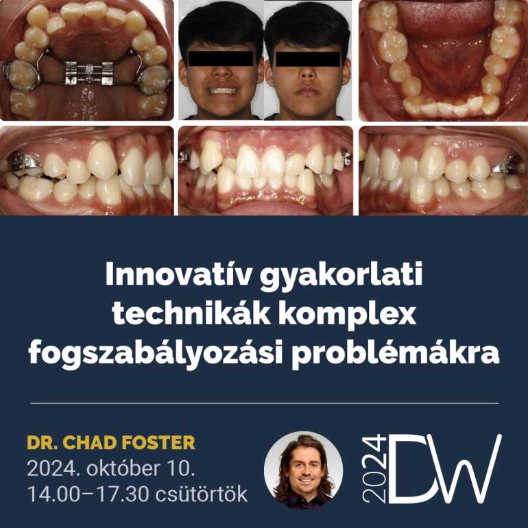 Innovatív gyakorlati technikák komplex fogszabályozási problémákra