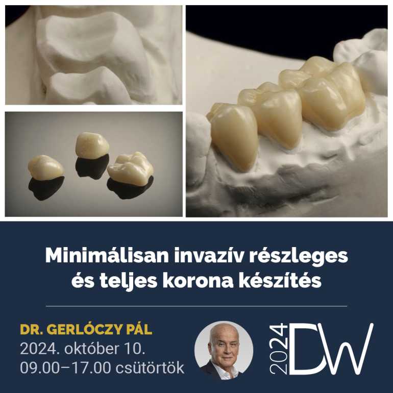 Minimálisan invazív részleges és teljes korona készítés