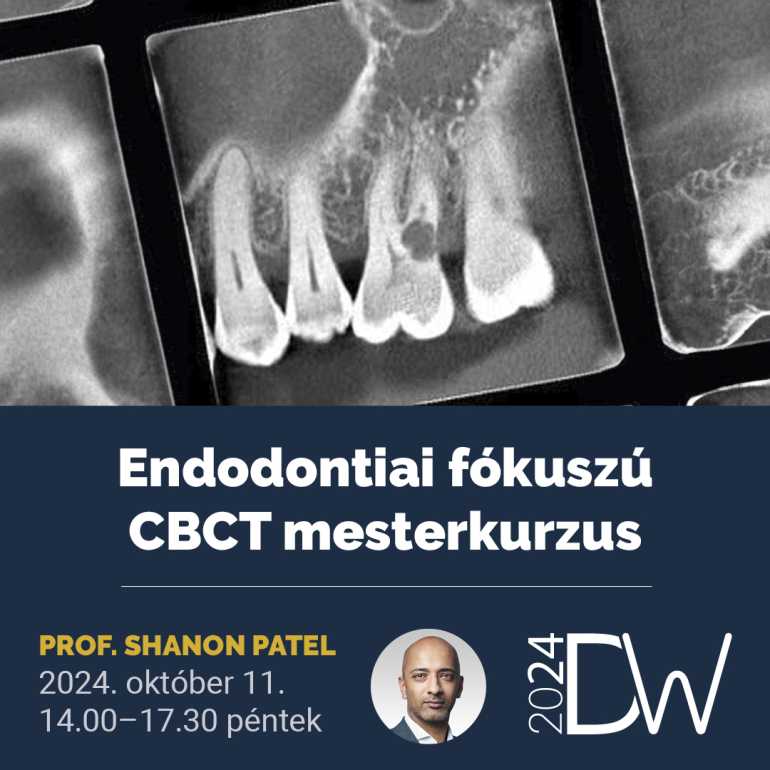 Endodontiai fókuszú CBCT mesterkurzus