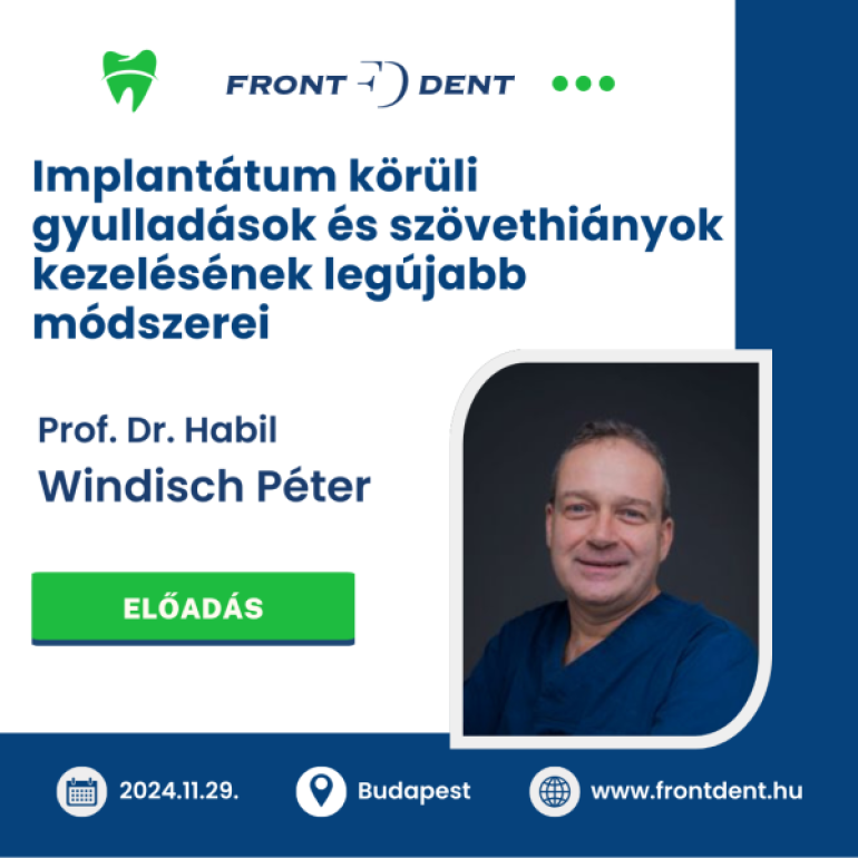 Implantátum körüli gyulladások, szövethiányok - előadás