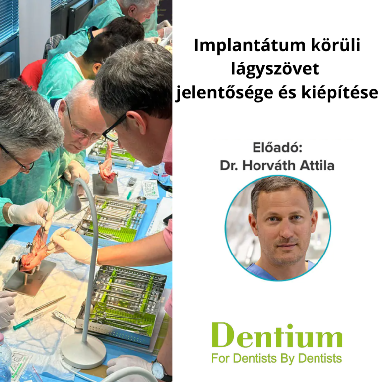 Implantátum körüli lágyszövet jelentősége és kiépítése