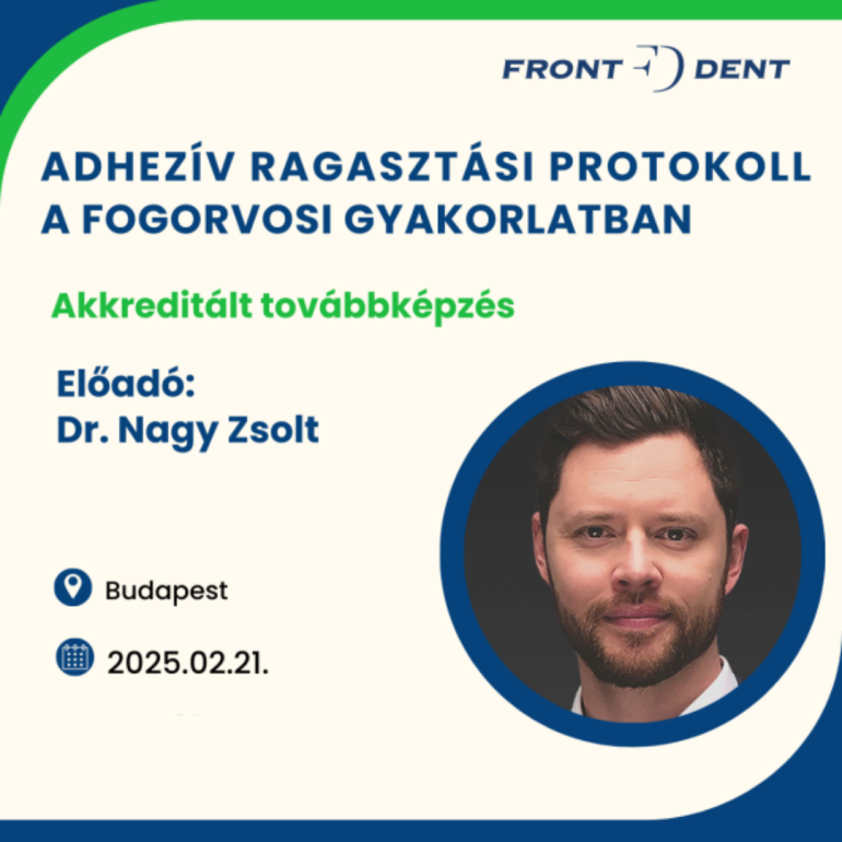 Adhezív ragasztási protokoll a mindennapi gyakorlatban