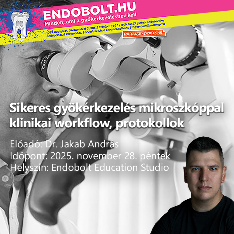 sikeres gyökérkezelés mikroszkóppal - klinikai workflow, protokollok