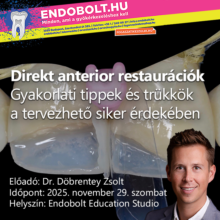 Direkt anterior restaurációk