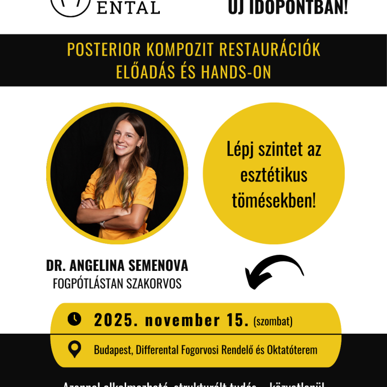 Foundation Posterior Kompozit kurzus és hands-on