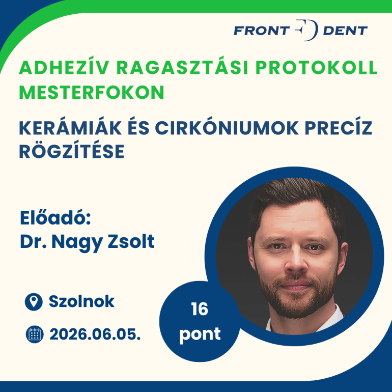 Adhezív ragasztási protokoll a mindennapi gyakorlatban