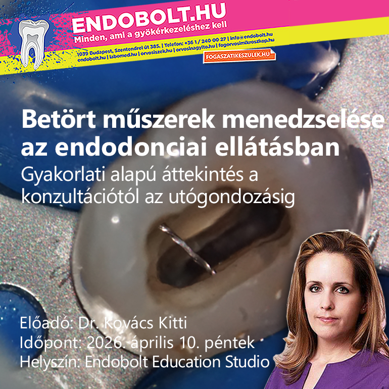 Betört műszerek menedzselése az endodonciai ellátásban