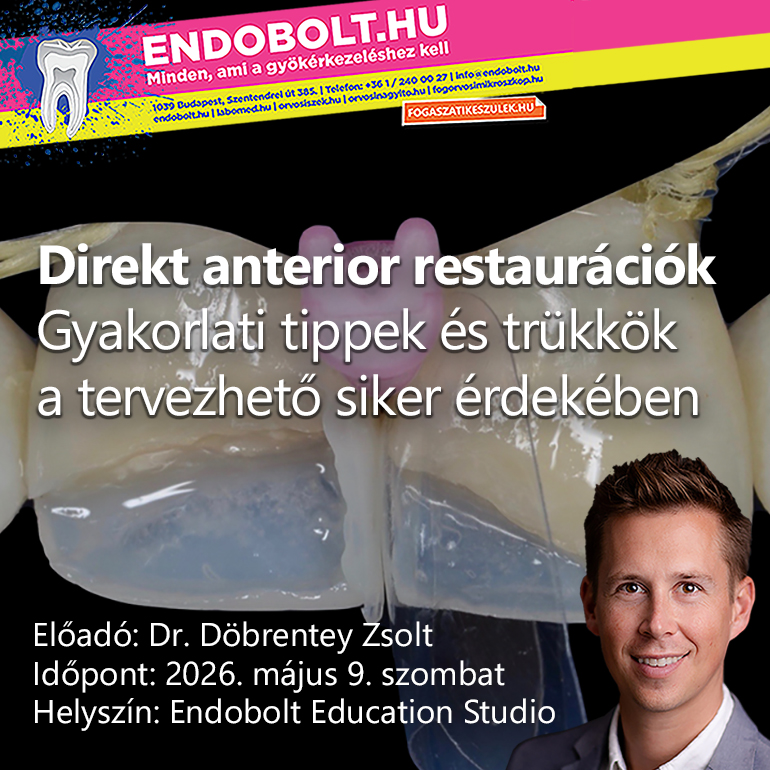 Direkt anterior restaurációk